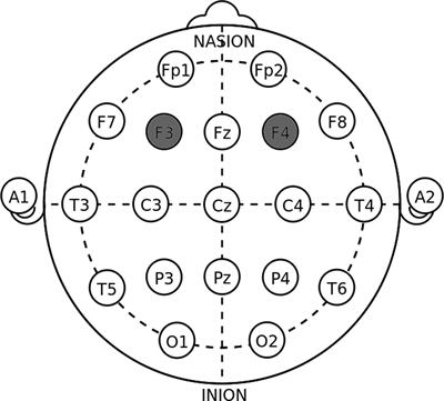 Does Gender Make a Difference in Deception? The Effect of Transcranial Direct Current Stimulation Over Dorsolateral Prefrontal Cortex